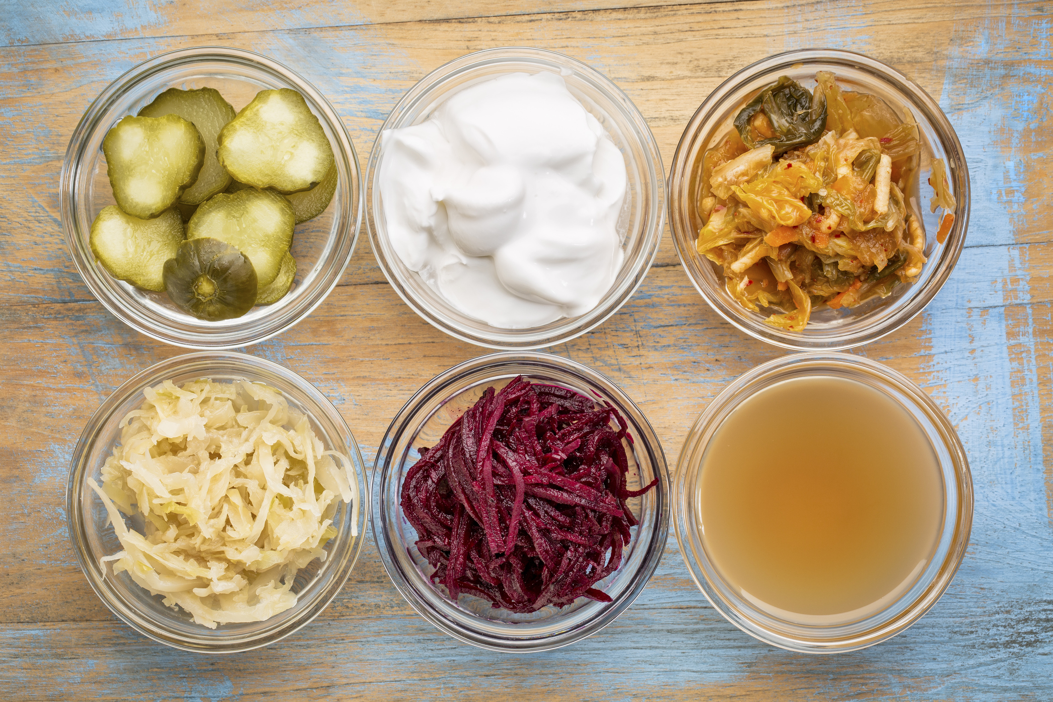 array of fermented dishes